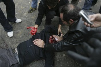 A demonstrator who was shot during anti-government protests in Tehran on Sunday, Dec. 27, 2009.