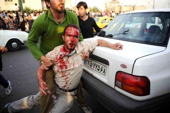 Wounded protester. Photo by .faramarz